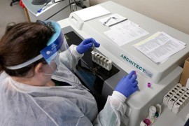 U Institutu za javno zdravstvo Srpske testiranje na HIV