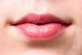 Imate suve i ispucale usne? Nedostatak ovih vitamina može da bude uzrok