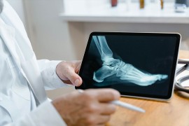 Radiolozi ne idu nikuda, uprkos procjenama