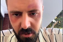 Srpski pjevač tvrdi da je pretučen: "Nije mi dobro, treba mi pomoć" ...