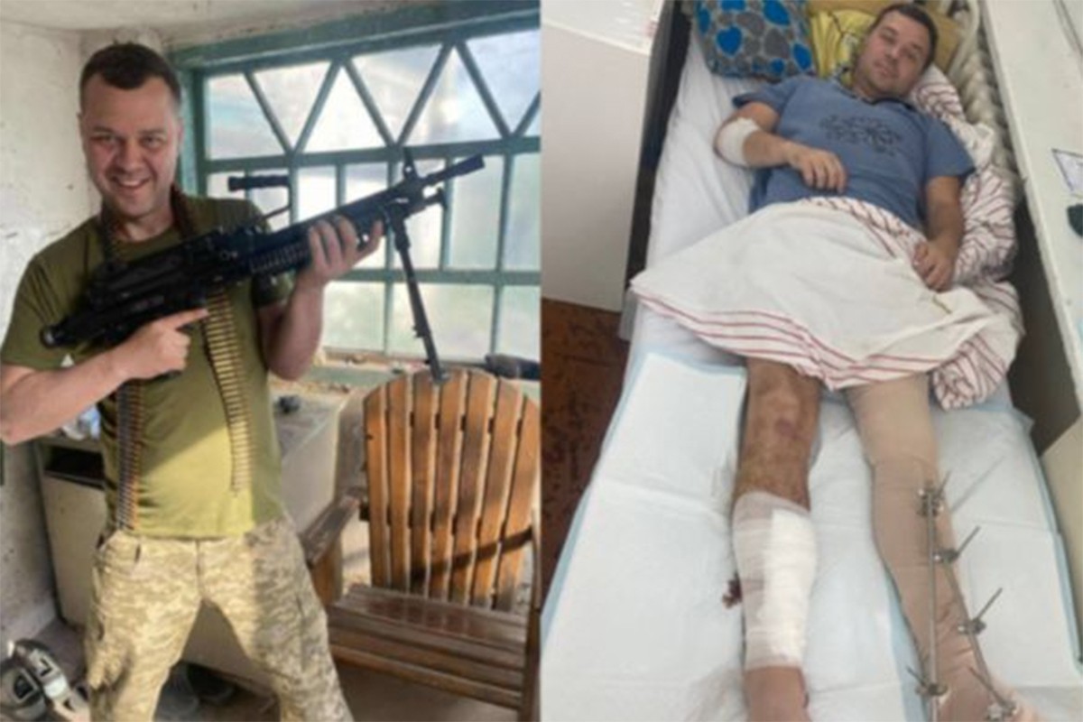 Proslavljeni ukrajinski sportista teško ranjen na prvoj liniji fronta