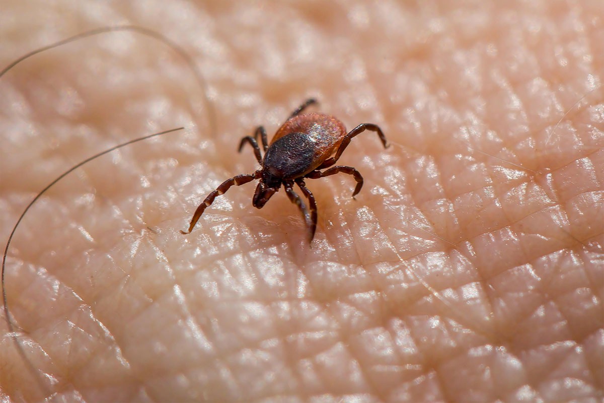 Rijedak virus se pojavio u Evropi: Krpelj usmrtio muškarca, ljekar zaražen