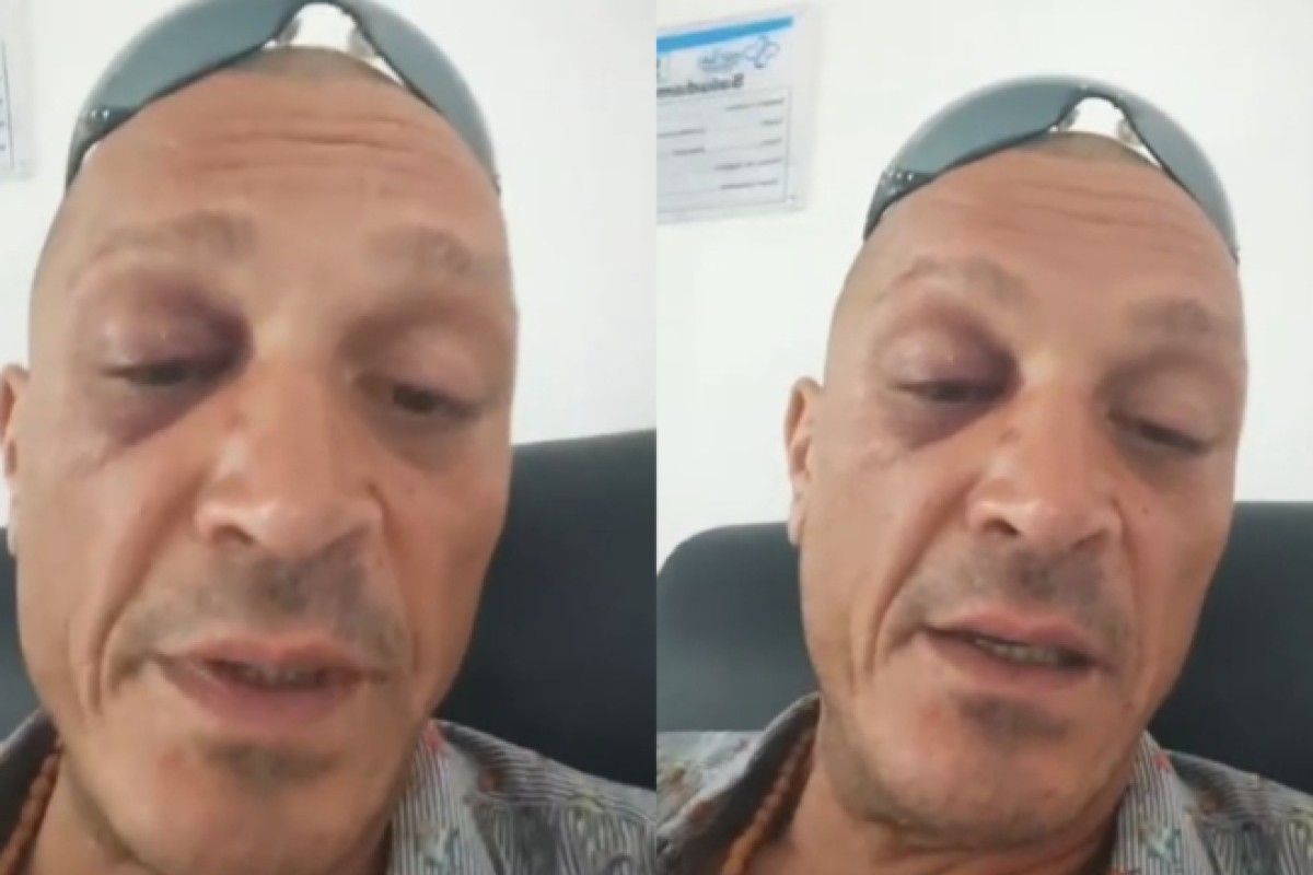 Sin poznatog pjevača zapeo u Kolumbiji: “Uzeli su mi novac i pasoš i prebili me” (VIDEO)