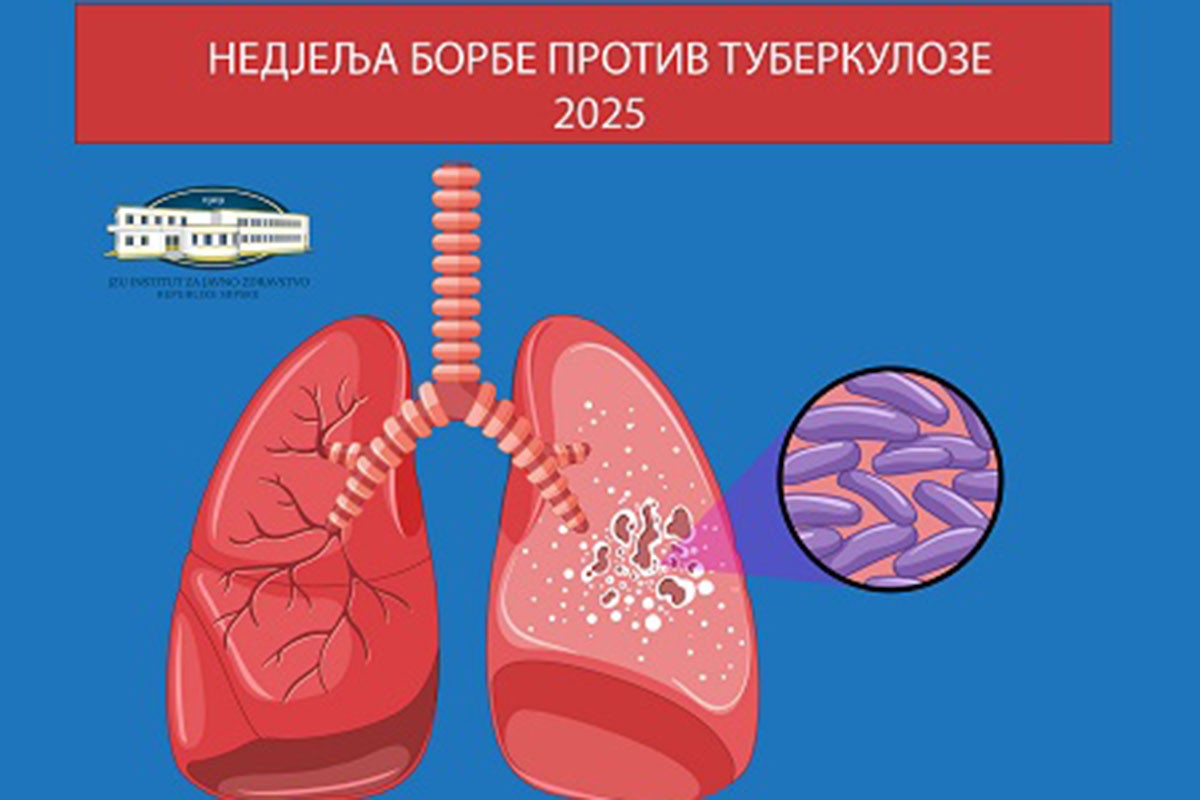 U Srpskoj za godinu dana 114 nоvооbоljеlih od tuberkuloze