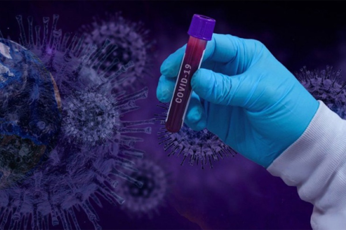 Otkriven biološki dokaz produženog kovida