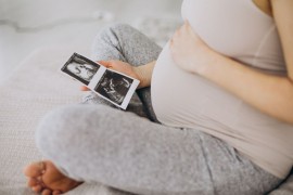 Fond zdravstva Republike Srpske: Troškove za prenatalne testove ...