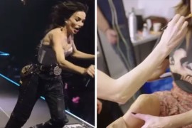 Severina pokazala modrice od pada na koncertu (VIDEO)