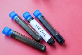 Testiranje na HIV širom BiH: 18 lokacija nudi besplatne i anonimne ...