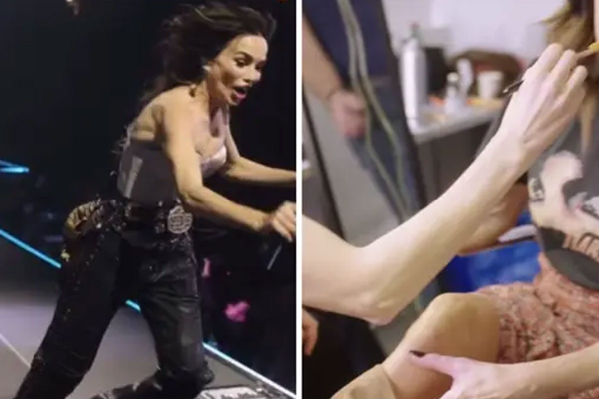 Severina pokazala modrice od pada na koncertu (VIDEO)