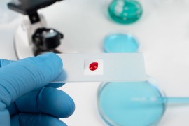 Vukmirova: U Srpskoj ove godine registrovano osam osoba sa HIV/AIDS-om