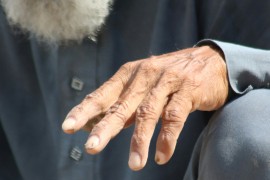 Nakon pojave gube u regionu, Batut poručuje: Nema razloga za paniku