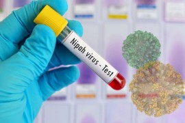 Virus Nipah nije registrovan u Srpskoj: Gdje postoji rizik i ko treba ...