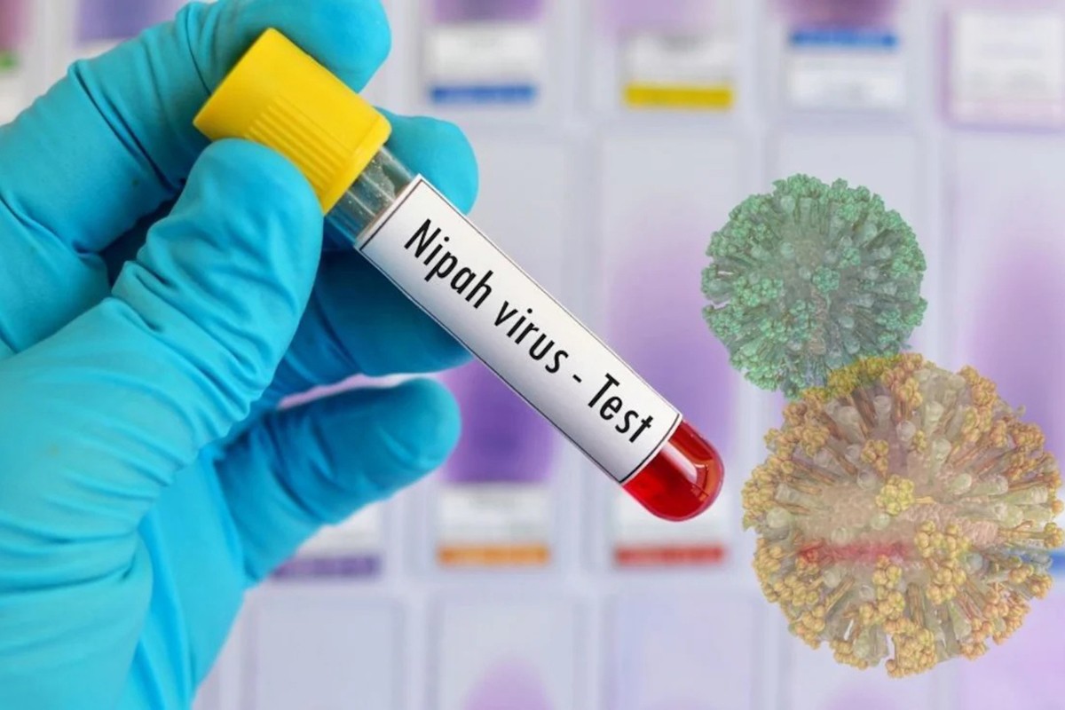 Virus Nipah nije registrovan u Srpskoj: Gdje postoji rizik i ko treba da bude oprezan?
