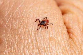 Sezona krpelja počela: Obratite pažnju na ovaj simptom