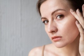Tamne fleke na licu ne prolaze? Evo 6 grešaka koje treba izbjegavati