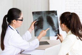 U Srpskoj 113 oboljelih od tuberkuloze, šest osoba preminulo