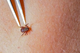 Najezda krpelja zabrinula građane, stručnjaci izdali važno upozorenje