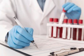 Hepatitis često nema simptome: U Srpskoj ove godine registrovano 29 ...