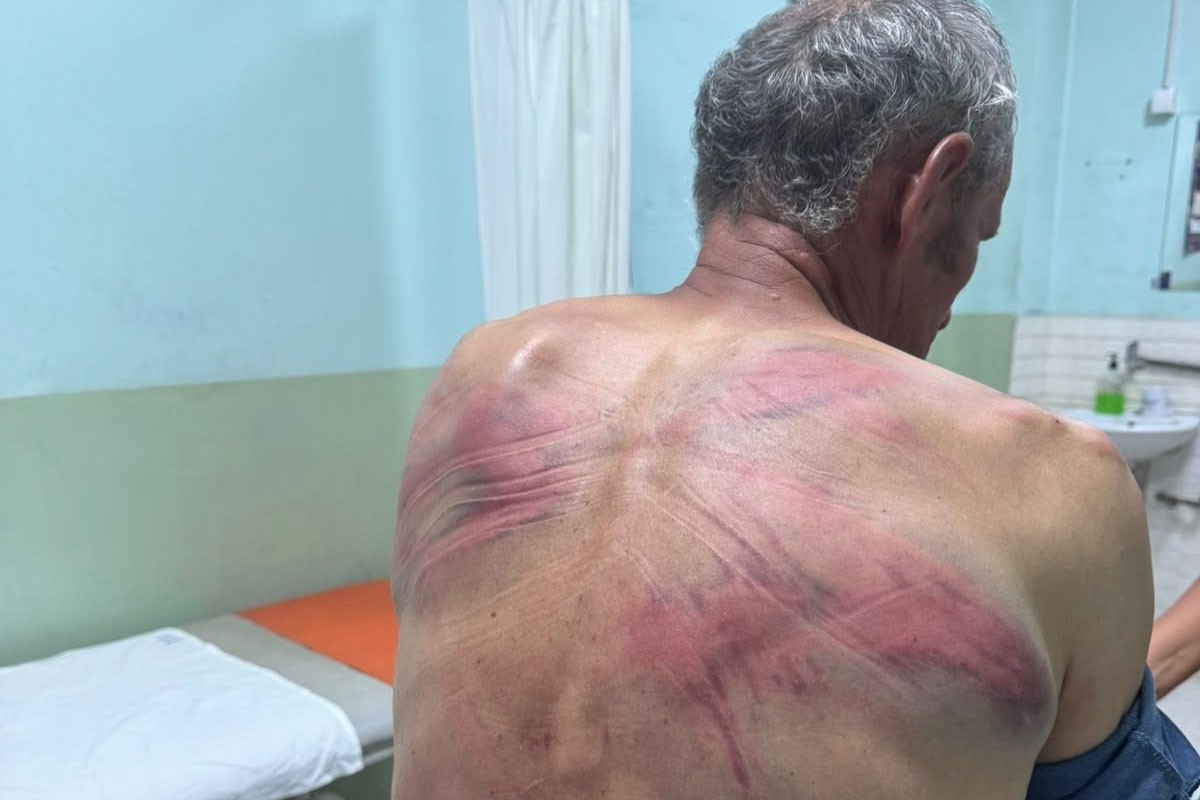Prijavljeno brutalno prebijanje na Kosovu: Rašković tvrdi da su ga policajci vezali za drvo