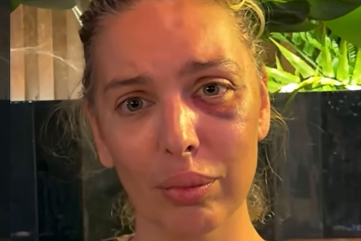 Ava Karabatić: Požar zahvatio očevu kuću, ostala sam bez ičega